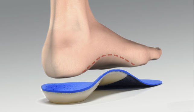 Custom foot orthotics