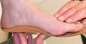 Custom foot orthotics fitting and assessment.